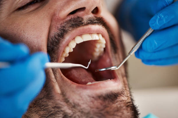 Best Emergency Treatment for Oral Infections in Myrtle Beach, SC
