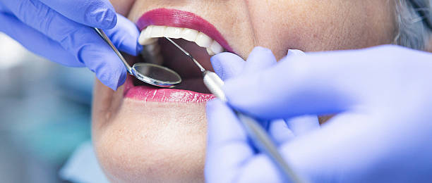 Best Emergency Denture Repair in Myrtle Beach, SC